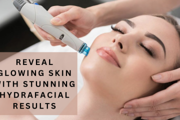 hydrafacial results